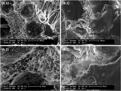 Chemically crosslinked hyaluronic acid-chitosan hydrogel for application on cartilage regeneration
